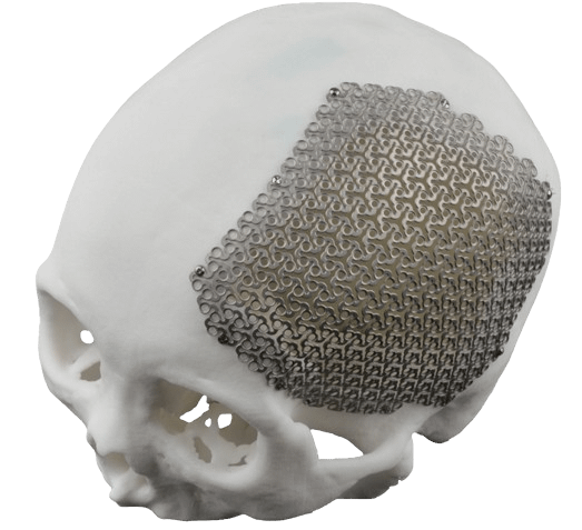 skull-removebg-preview